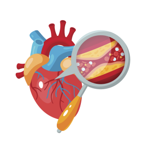 Bypass heart surgery