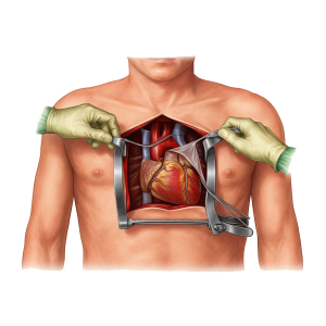 open heart surgery treatment in Hyderabad
